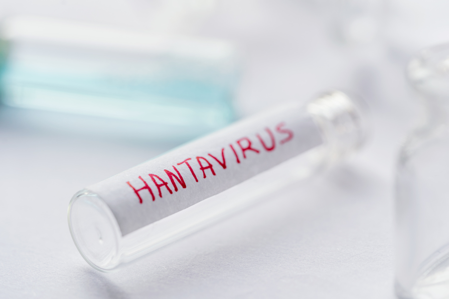 HANTAVIRUS ADESLAS CIUDAD REAL1